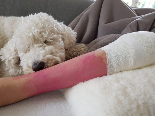 Hond Roos is extra lief voor Fleur na knie-operatie